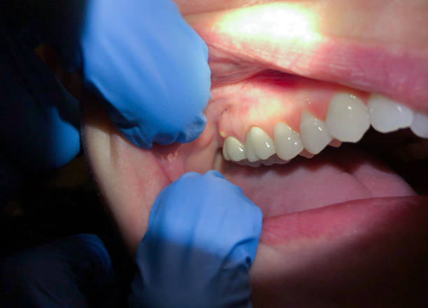 Audubon Park, NJ Emergency Dentist Pros